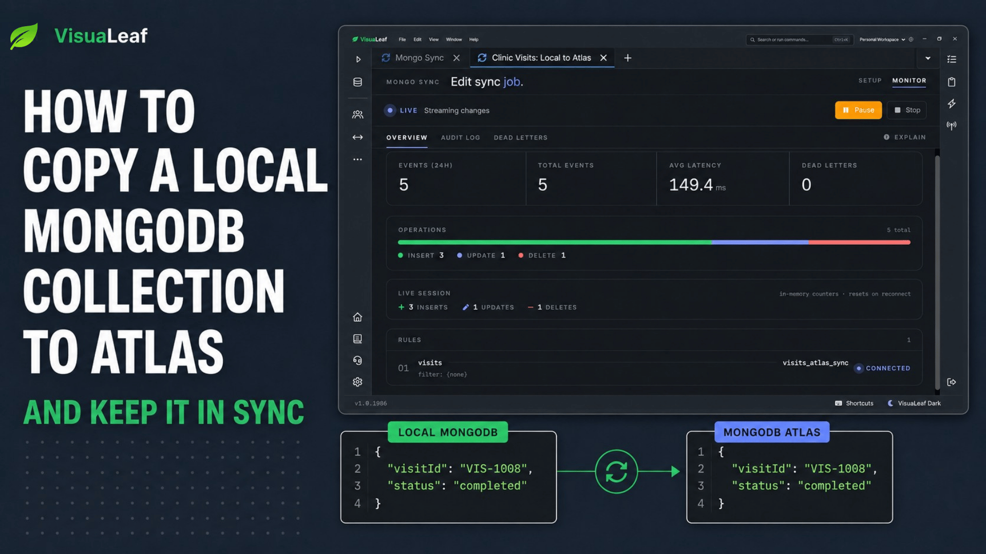 VisuaLeaf Mongo Sync dashboard showing a live sync from a local MongoDB collection to MongoDB Atlas, with matching JSON documents on both sides.